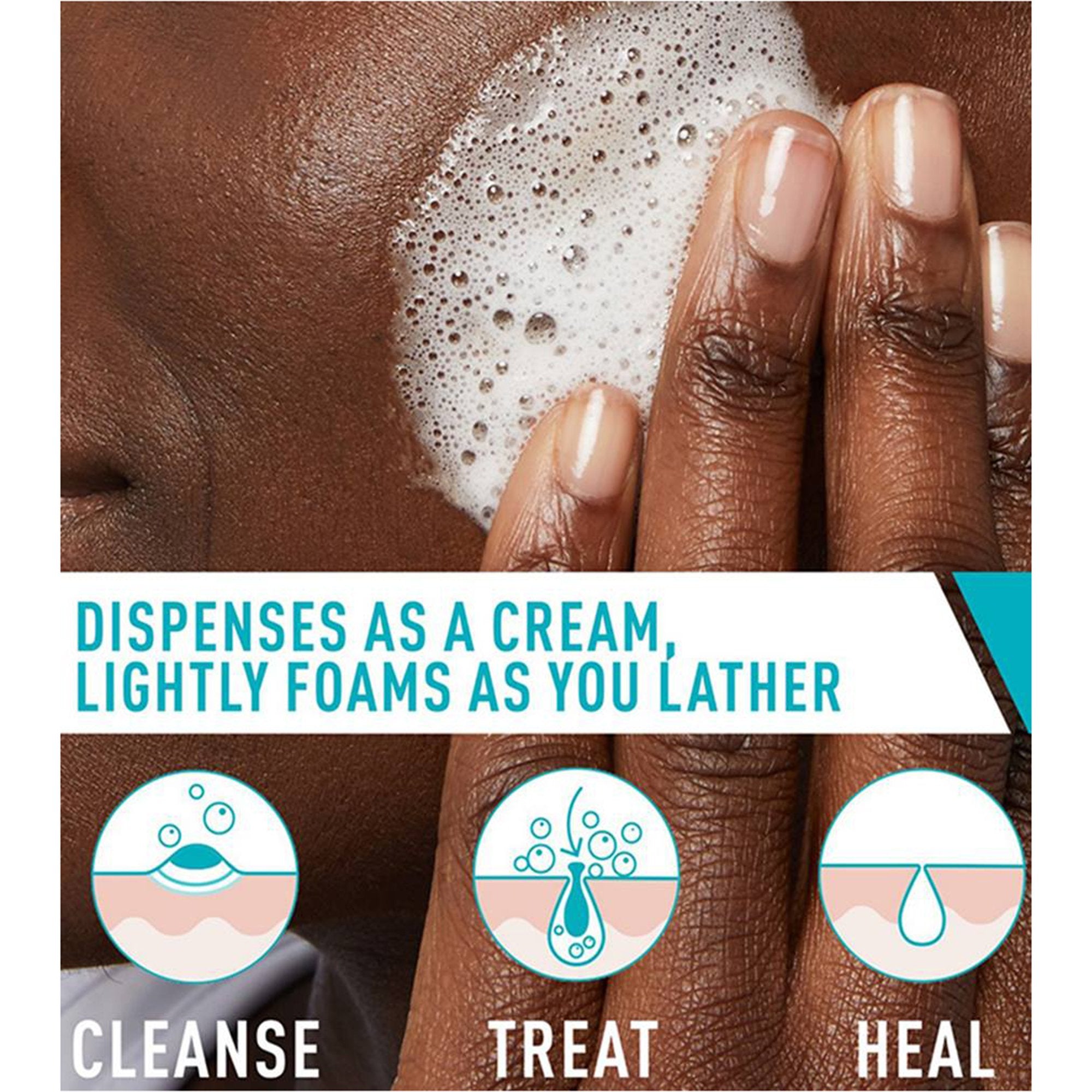 CeraVe Acne Foaming Cream Cleanser