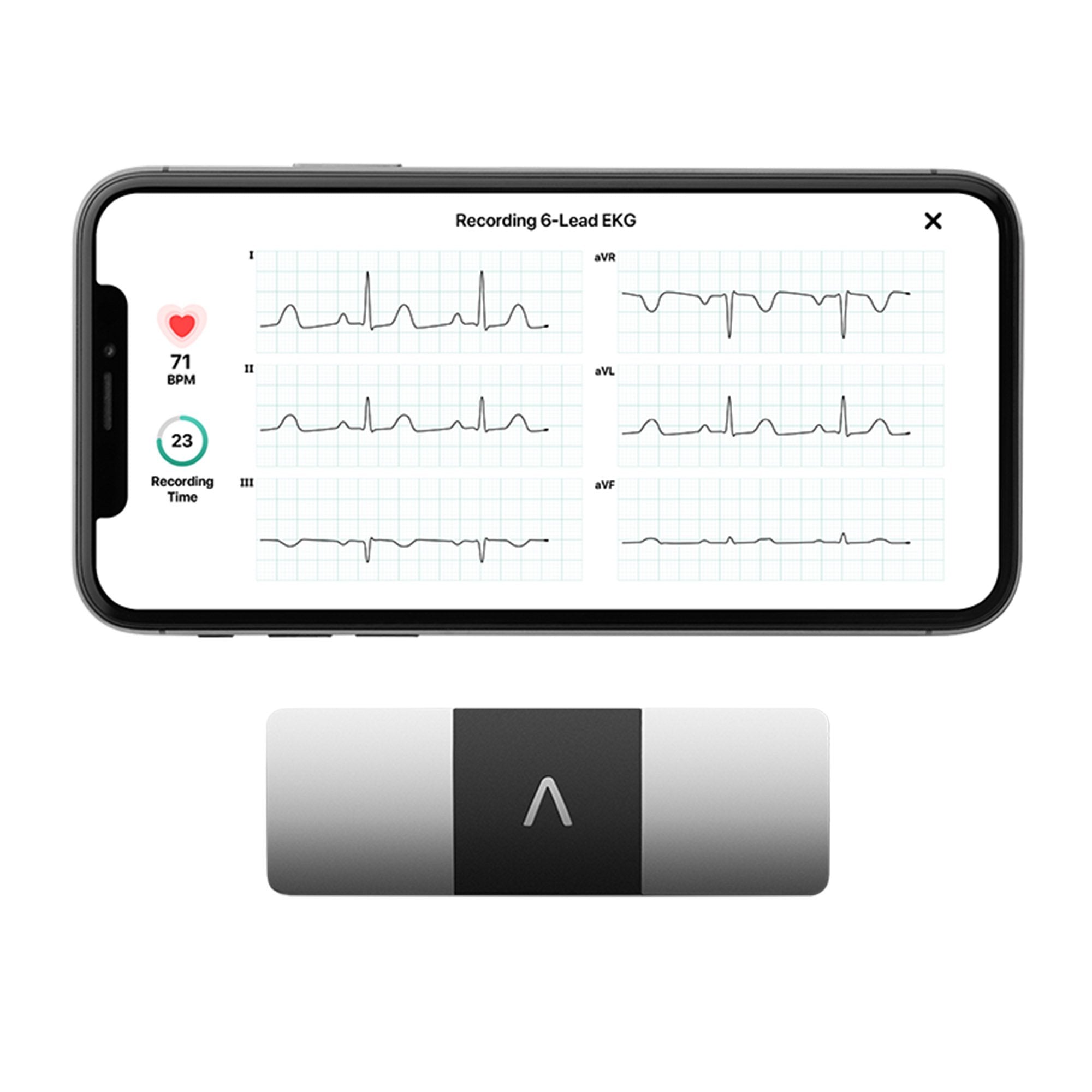 KardiaMobile 6L Electrocardiograph