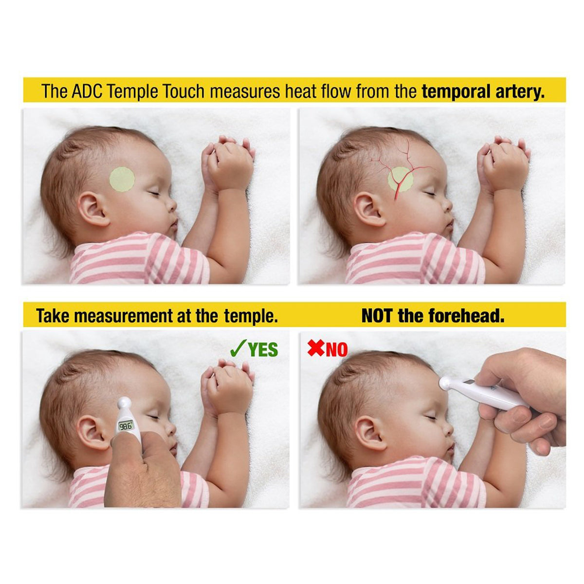 ADC AdTemp 427 TempleTouch Digital Temporal Thermometer